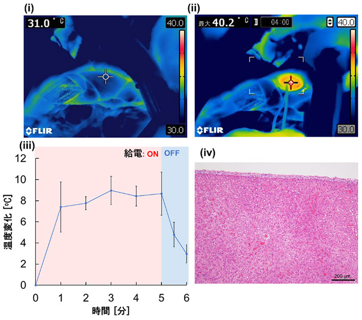 図3. (i)発熱デバイス貼付前の肝臓表面の赤外線サーモグラフィ画像、(ii)5分間の給電後の表面温度、(iii)給電の有無による発熱デバイス表面の温度変化、(iv)実験終了後の肝臓病理組織像(論文 Figure 6c-fを改変のうえ転載)