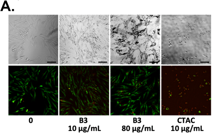 上パネルは位相差画像、下パネルは蛍光顕微鏡画像(緑:Calcein-AMで染色した生細胞、赤:Propidium iodideで染色した死細胞)(Scale bar:100 µm)