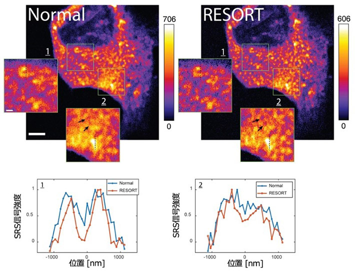 図2 (上)細胞内ミトコンドリアのRESORT画像。(下)画像中の点線部のクロスセクション。 通常のSRS画像(Normal)では分解できなかった構造がRESORTイメージングでは分解されて観察される。