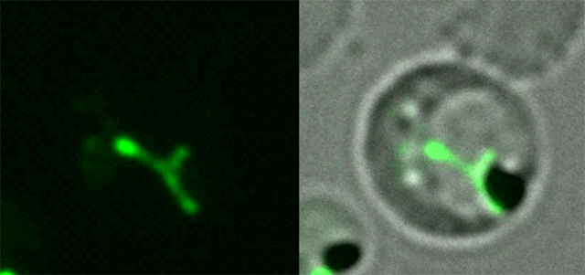 図2. GFP(緑色蛍光タンパク質)を発現させることでアピコプラスト(緑)を可視化した 熱帯熱マラリア原虫の顕微鏡像(画像提供:東京都医学総合研究所・小松谷啓介研究員)