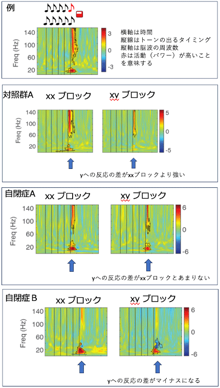 図4 観察された脳活動 